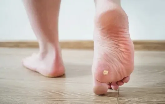 발 신경 통증을 설명하는 해부도