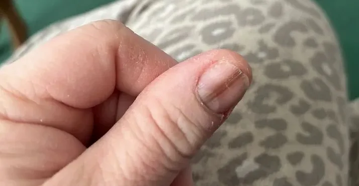 건강한 손톱 관리 모습