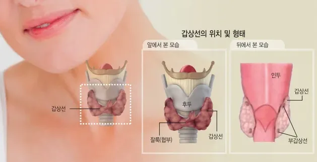 쉰 목소리를 호소하는 목 상태
