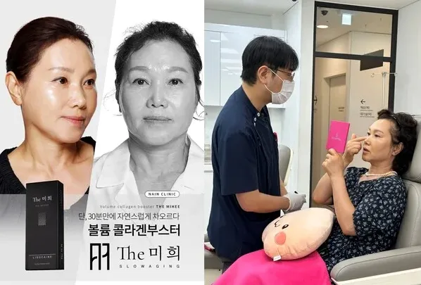 미용 시술 상담 장면