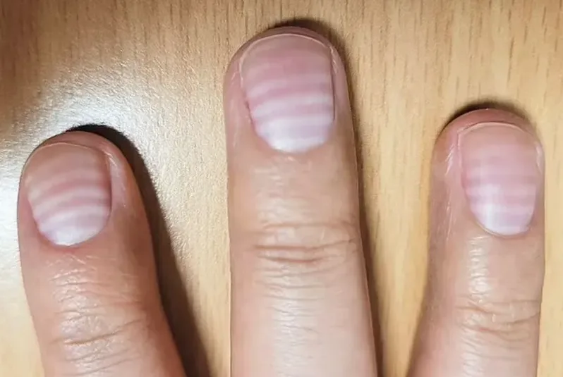 손톱 줄 폭을 가늠하는 모습