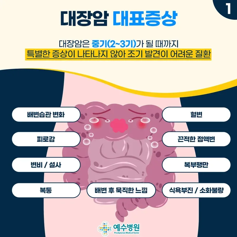 대장암 초기증상 놓치기 쉬운 신호 5가지 정리